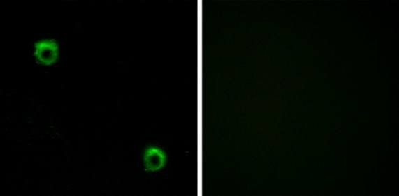 FZD2 Antibody
