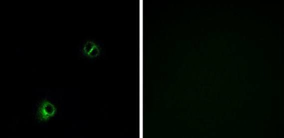 FZD9 antibody