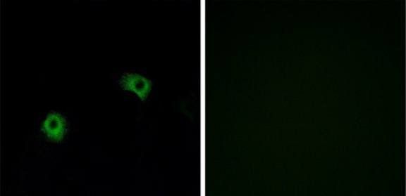 GPR116 antibody