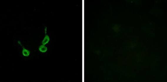 GPR150 Antibody