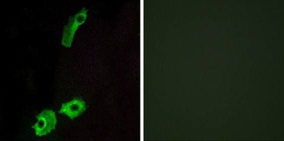 GPR151 Antibody