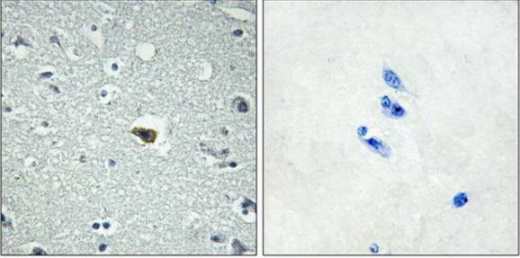 BAI1 Antibody