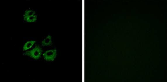 CCBP2 Antibody
