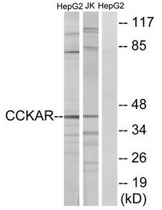 CCKAR Antibody