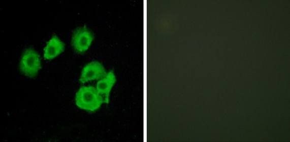 CLTR1 Antibody