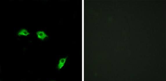 GABBR1 antibody