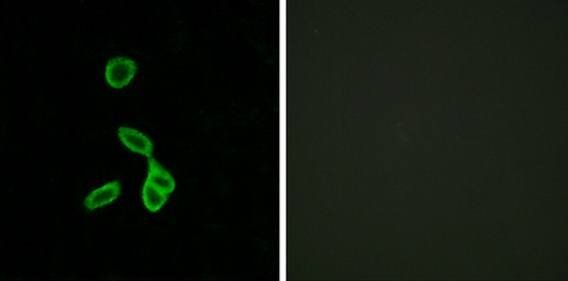 GALR1 Antibody