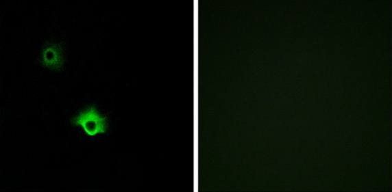 GALR3 Antibody