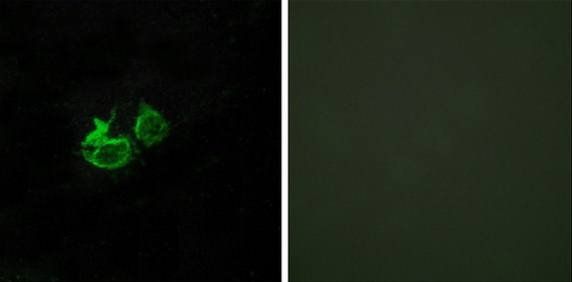 GHRHR antibody