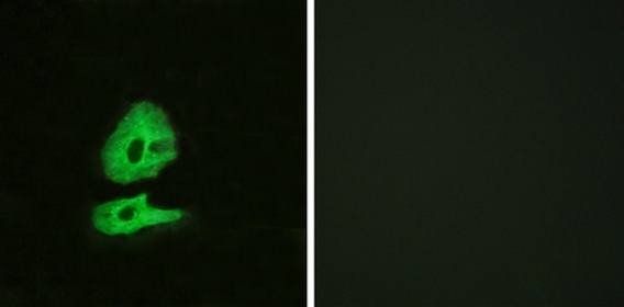 GLR Antibody