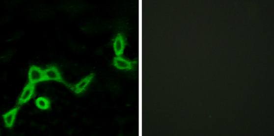 KISS1R Antibody