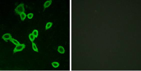 LGR6 antibody