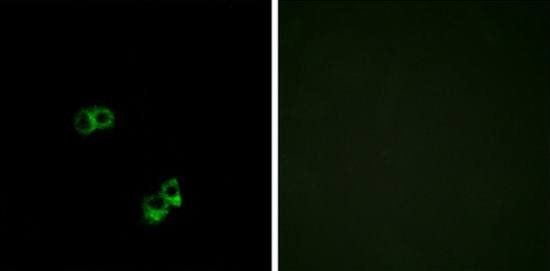 MC5R Antibody