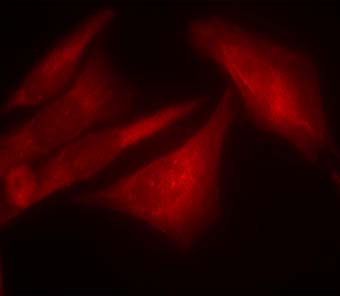 G3BP (Phospho-Ser232) Antibody