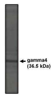 Rabbit Human Calcium Channel Antibody