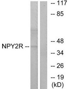 NPY2R antibody