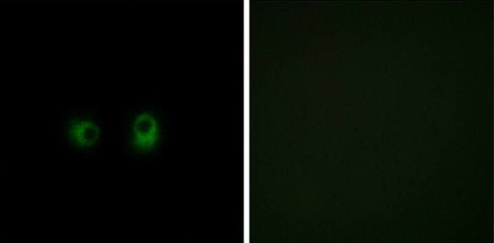 OR2AK2 Antibody