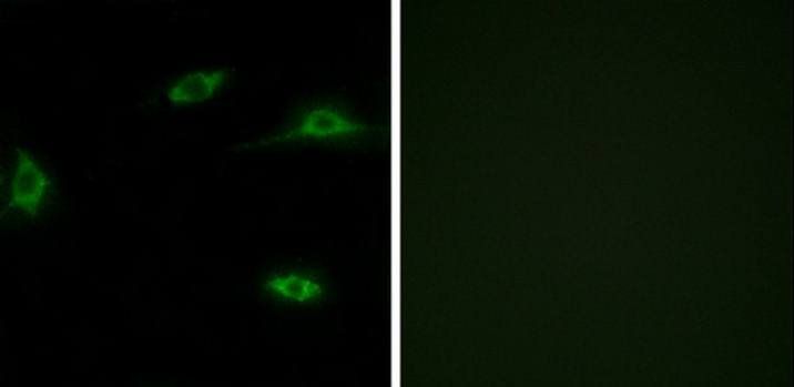 OR2T11 Antibody