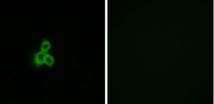 OR2T2/2T35 Antibody
