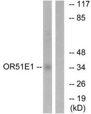 OR51E1 antibody