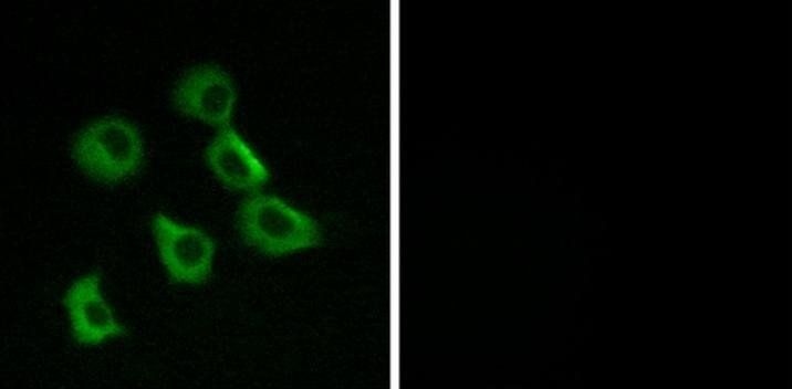 OR52B2 Antibody