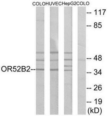 OR52B2 Antibody
