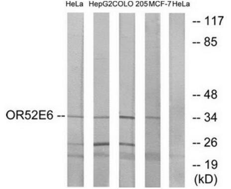 OR52E6 Antibody