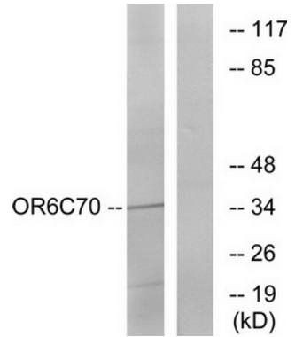 OR6C70 Antibody