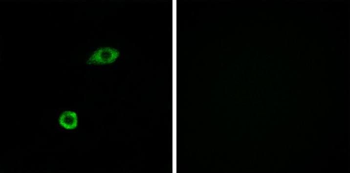 OR1B1 Antibody