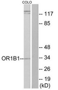 OR1B1 antibody