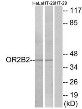 OR2B2 antibody