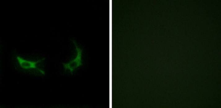OR2M3 Antibody