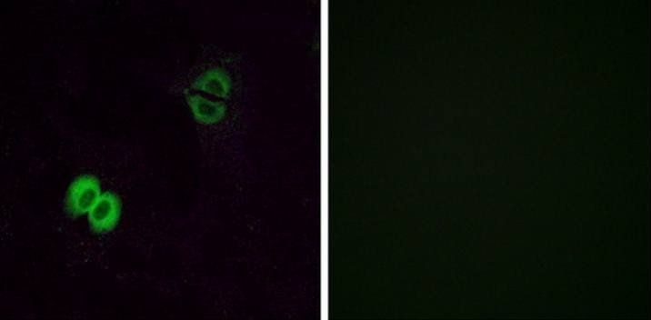 OR2T1 Antibody