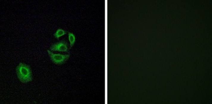 OR2T2/35 Antibody