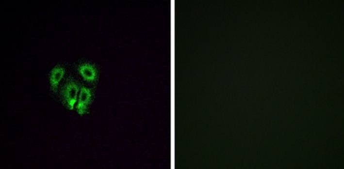OR4F4 Antibody