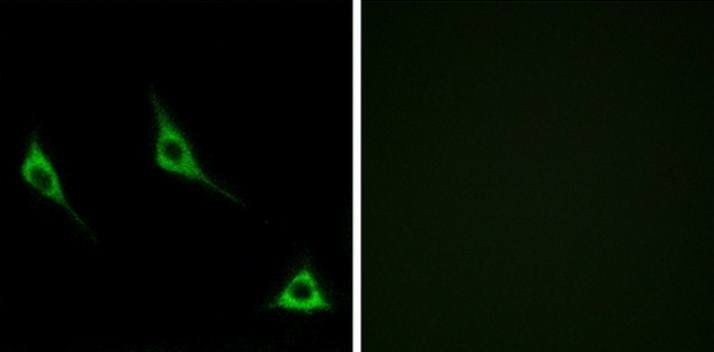 OR51A7 Antibody