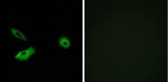 OR5AR1 Antibody