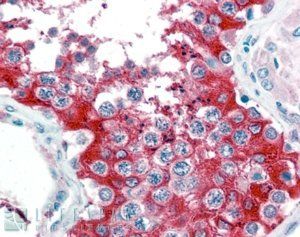 Goat anti-G6PD (aa 308 - 320) Antibody
