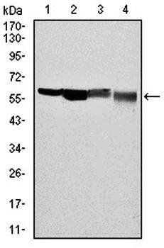 G6PD Antibody