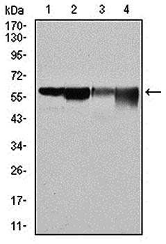 G6PD Antibody