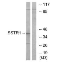 SSTR1 antibody