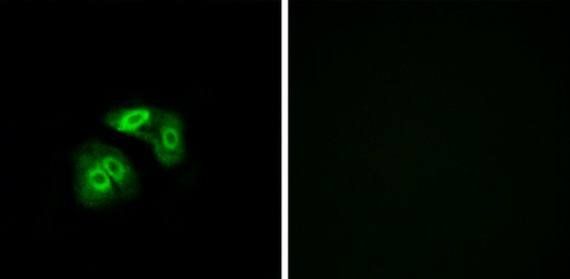 VN1R5 Antibody