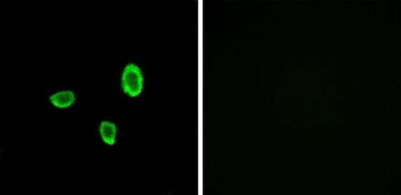 OR10G7 Antibody