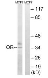 OR51H1 Antibody