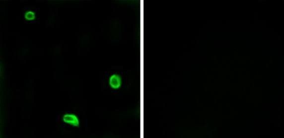 PAR4 Antibody
