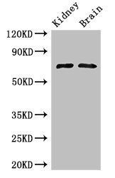 GAA antibody