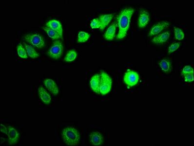 GAB1 Antibody