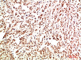 GAB1 Antibody