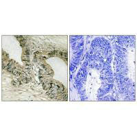 GAB2 (Ab-159) Antibody