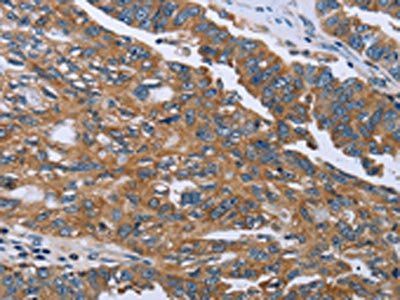 GAB2 Antibody